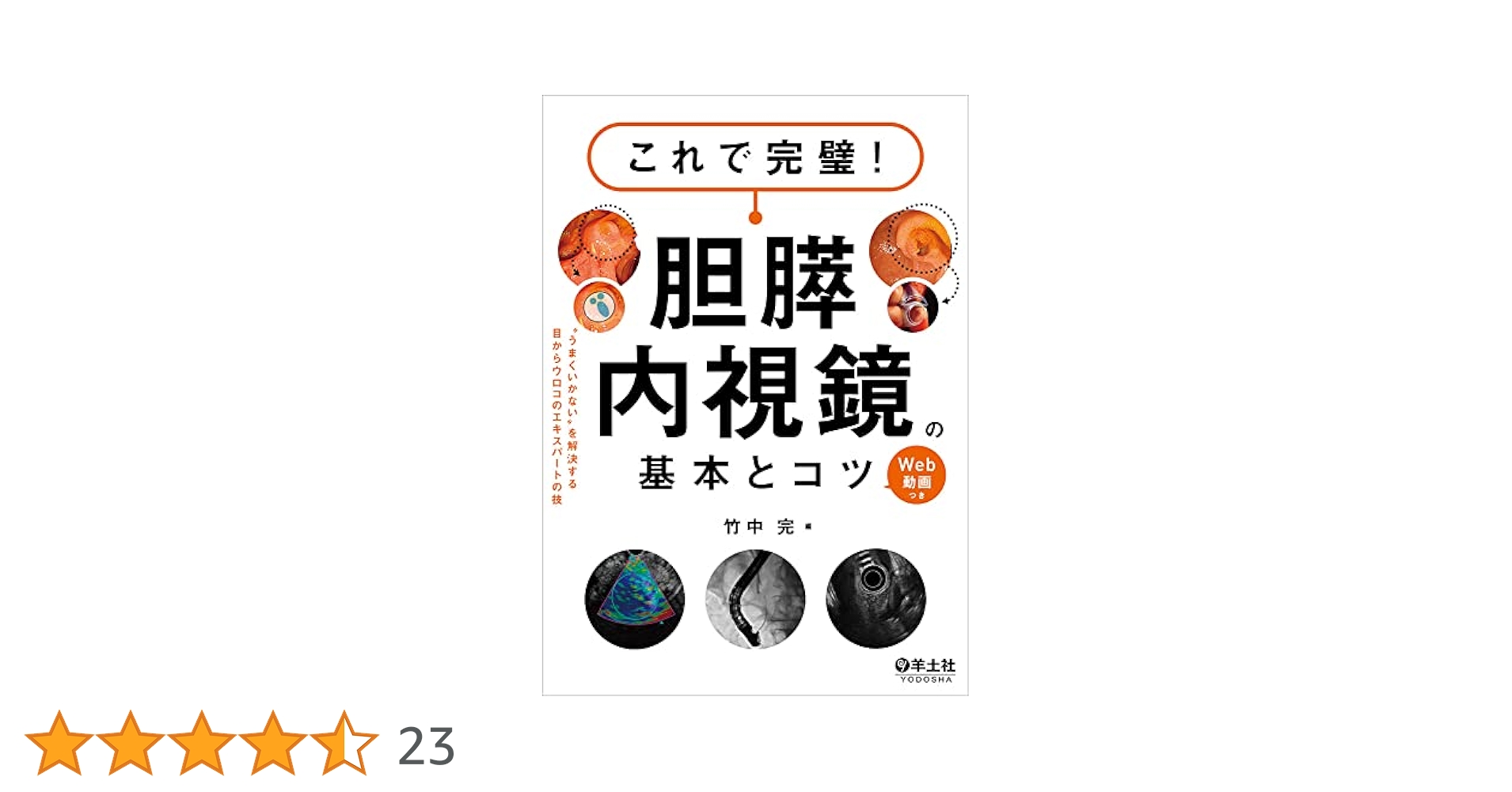 これで完璧!胆膵内視鏡の基本とコツ これで完璧! 胆膵内視鏡の基本とコツ〜“うまくいかない